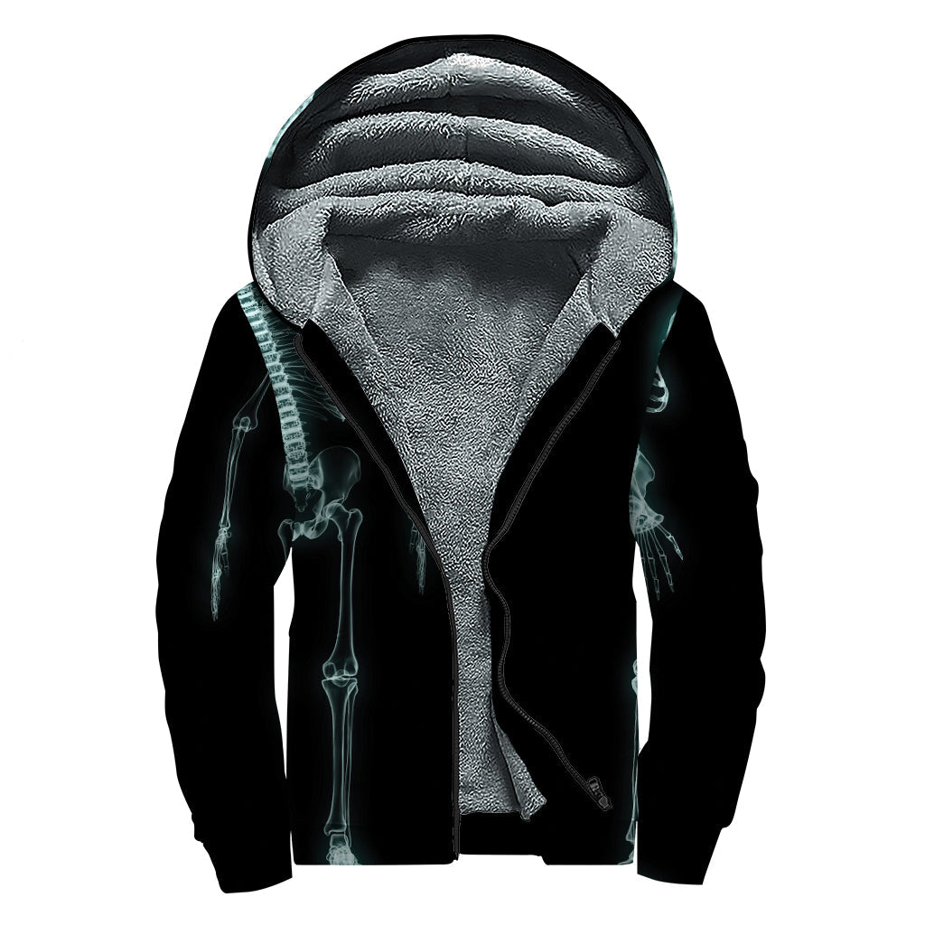 Human Skeleton X-Ray Sherpa Lined Zip Up Hoodie: Embrace Your Inner Hippy - 1