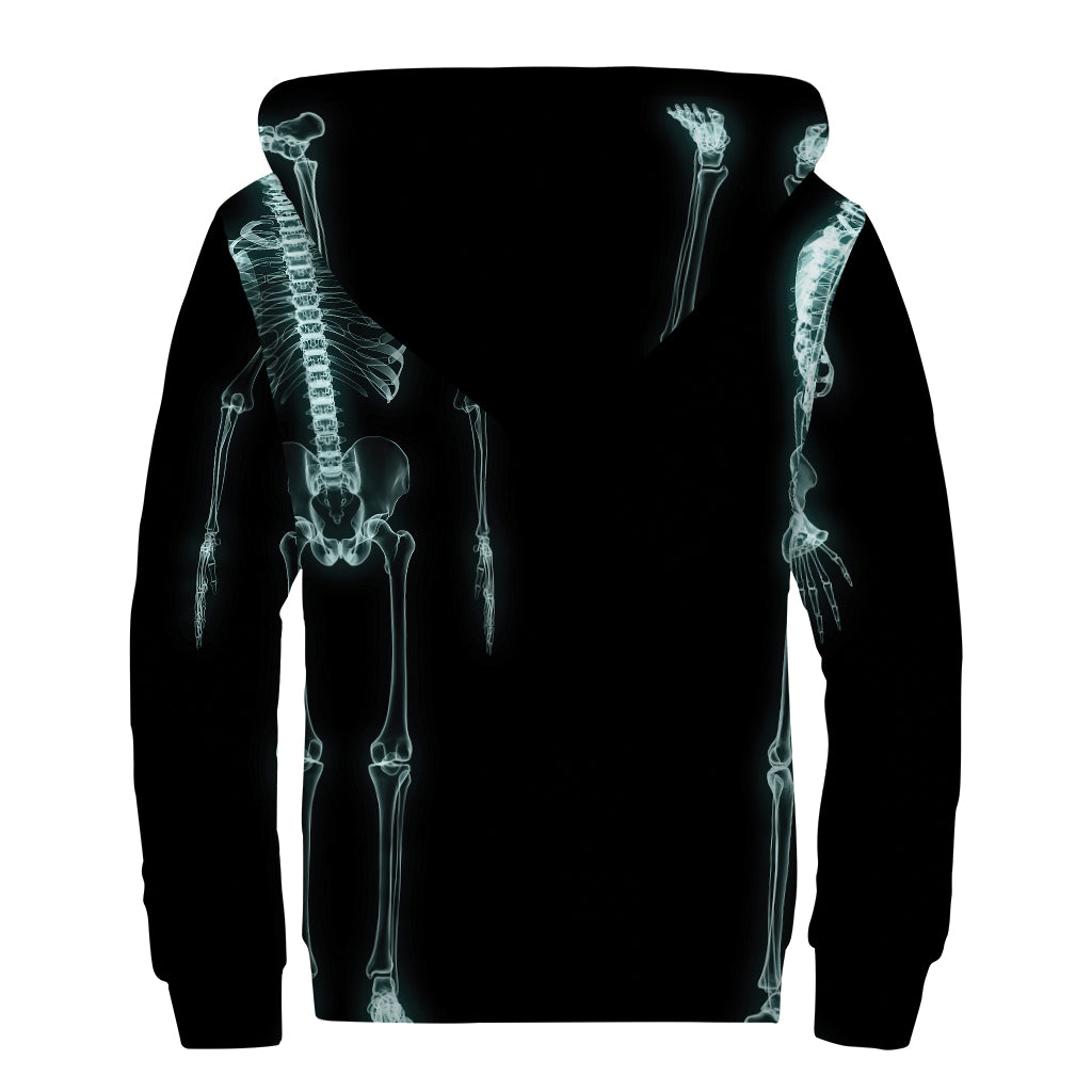 Human Skeleton X-Ray Sherpa Lined Zip Up Hoodie: Embrace Your Inner Hippy - 2