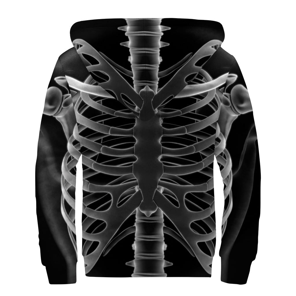 Radiologist X-Ray Film Print Sherpa Lined Zip Up Hoodie - Embrace Your Inner Hippie Style! - 2