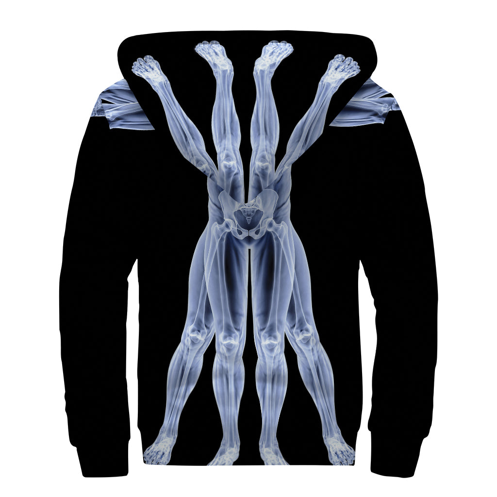 Vitruvian Man X-Ray Print Sherpa Lined Zip Up Hoodie: Groovy Hippie Style - 2